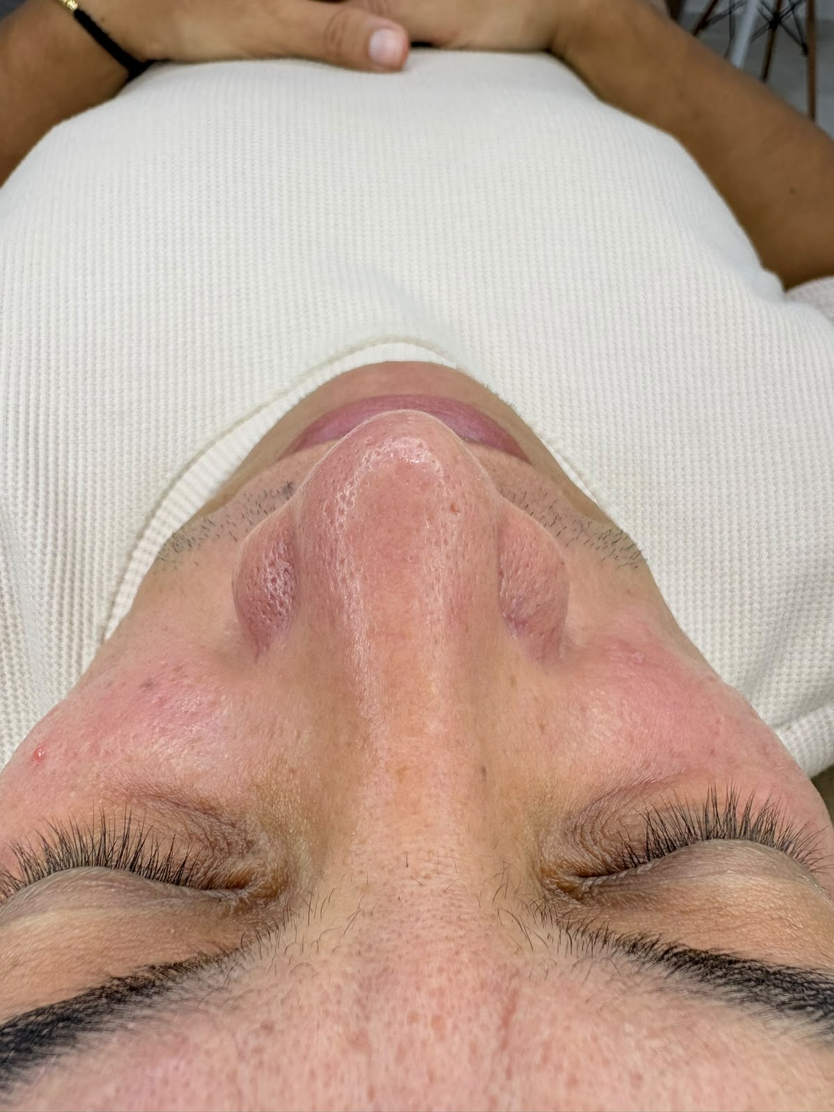 Foto del servicio LIMPIEZA FACIAL HIDRAFACIAL