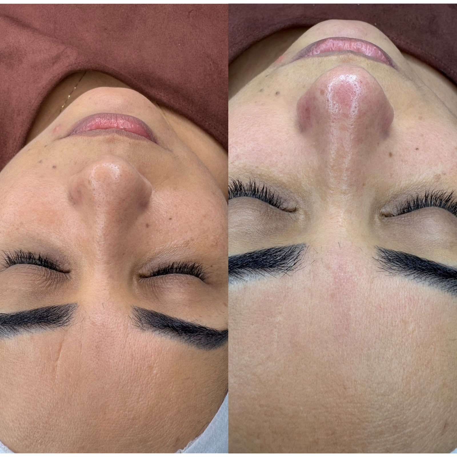 Foto del servicio LIMPIEZA FACIAL SKIN DETOX