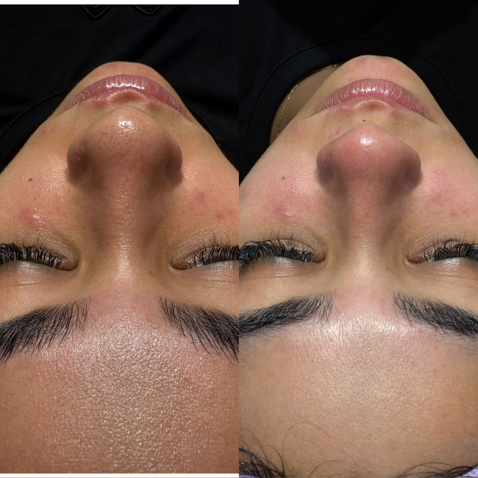Foto del servicio LIMPIEZA FACIAL SKIN DETOX