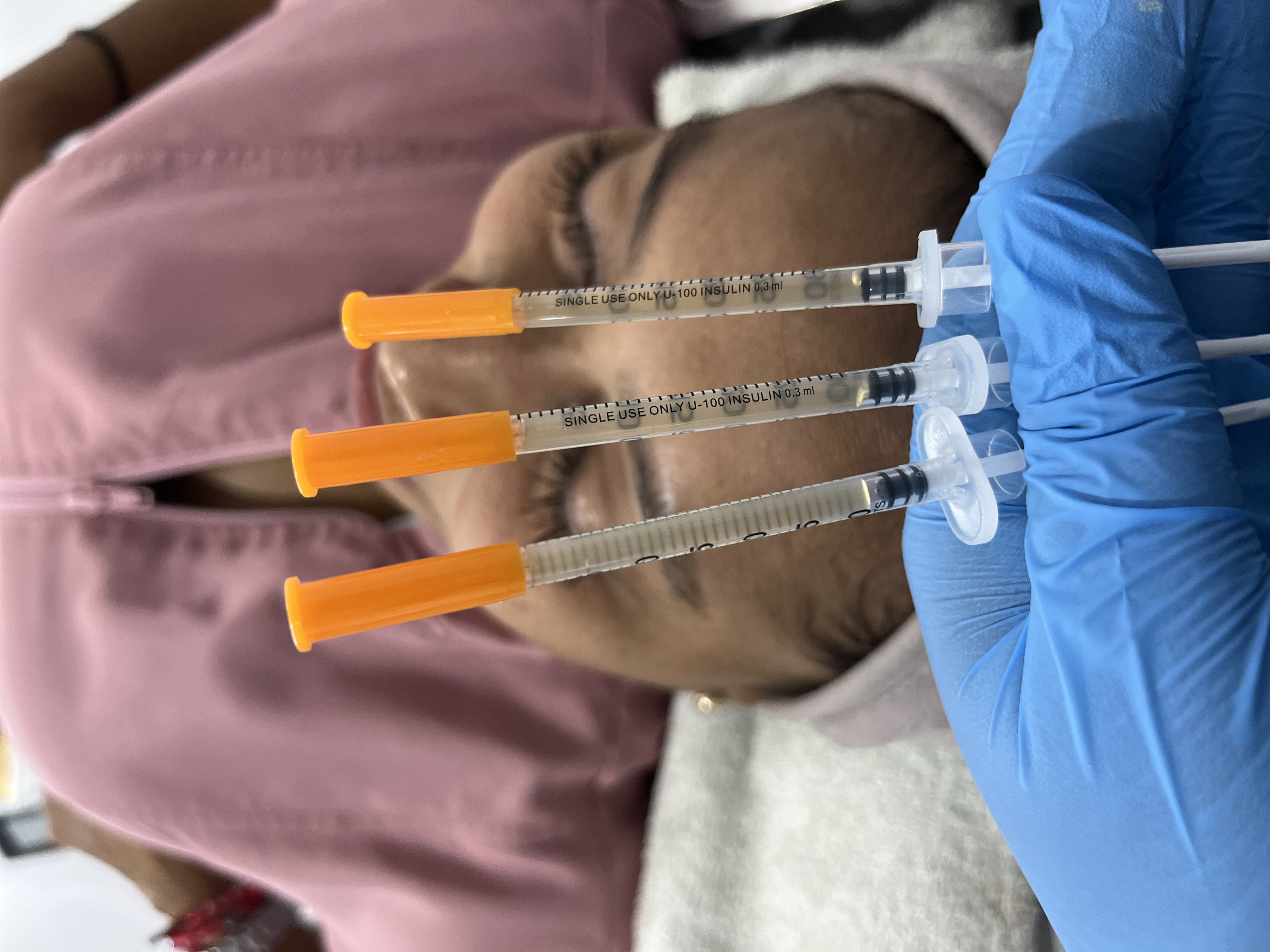 Foto del servicio PLASMA RICO EN FACTORES DE CRECIMIENTO