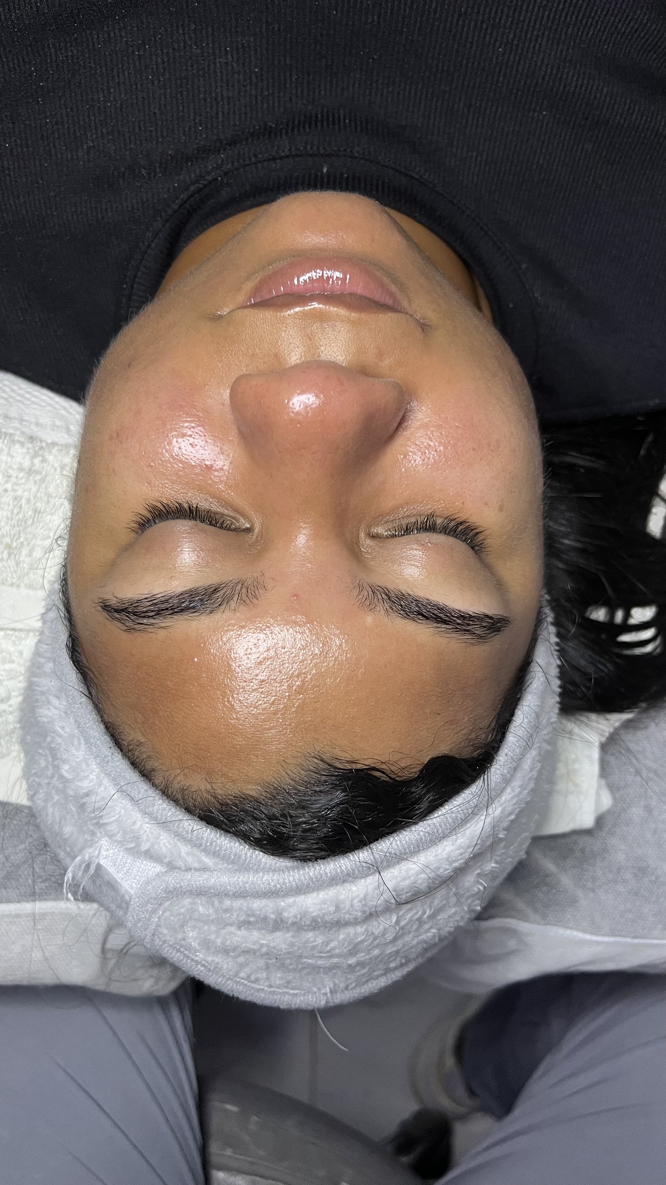 Foto del servicio LIMPIEZA FACIAL CON EXFOLIACIÓN MECÀNICA