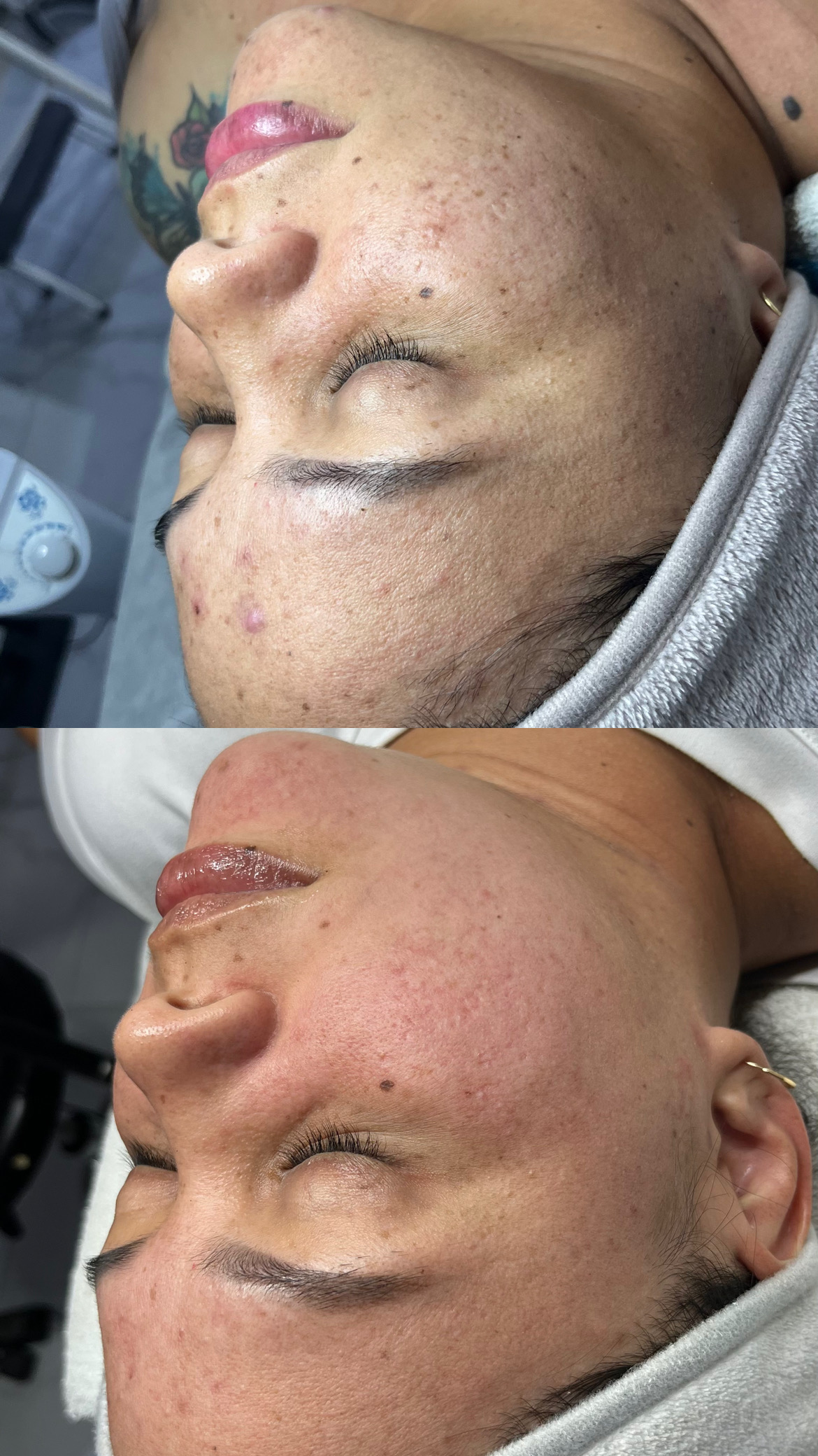 Foto del servicio TRATAMIENTO FACIAL DESPIGMENTANTE