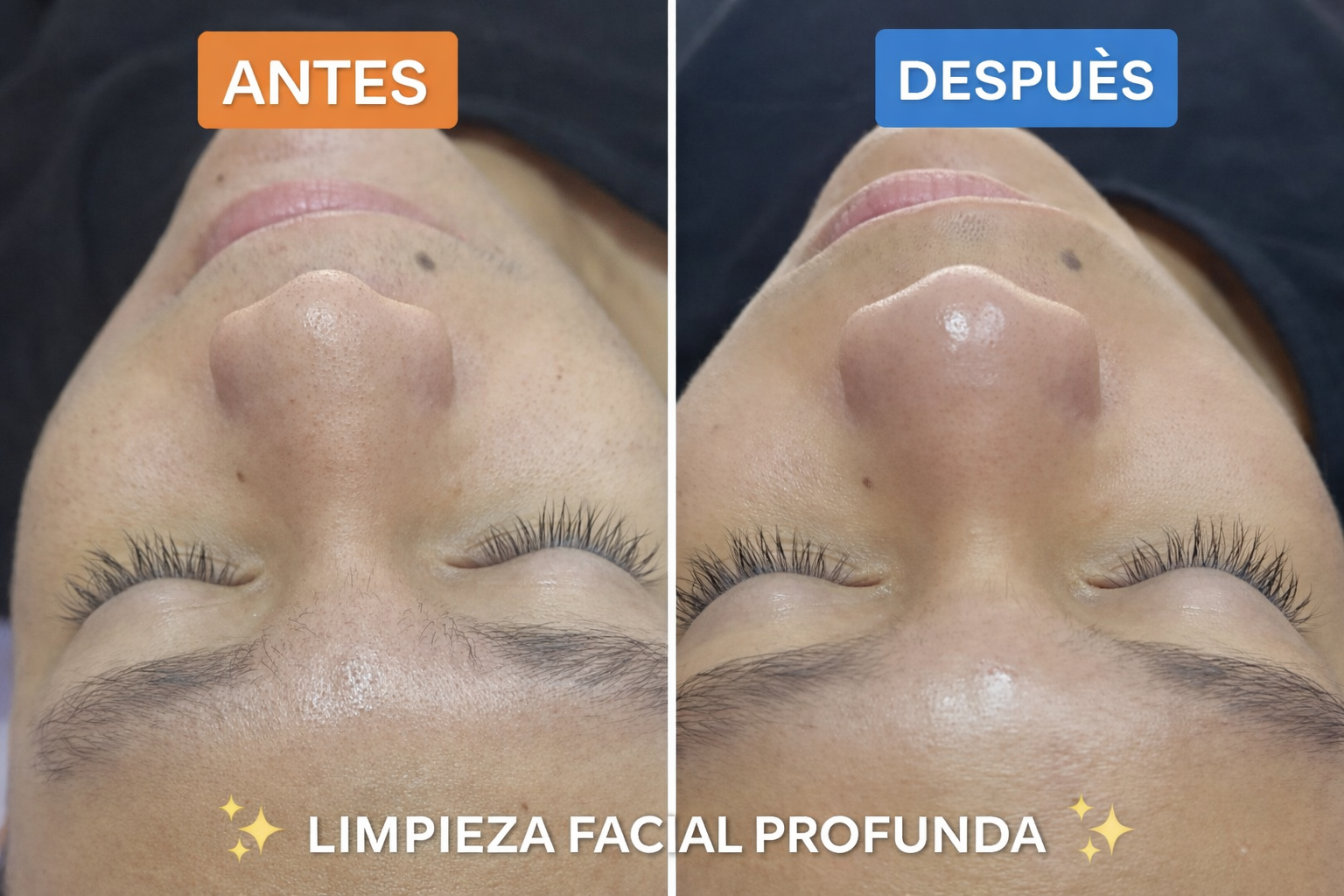 Foto del servicio Limpieza facial profunda