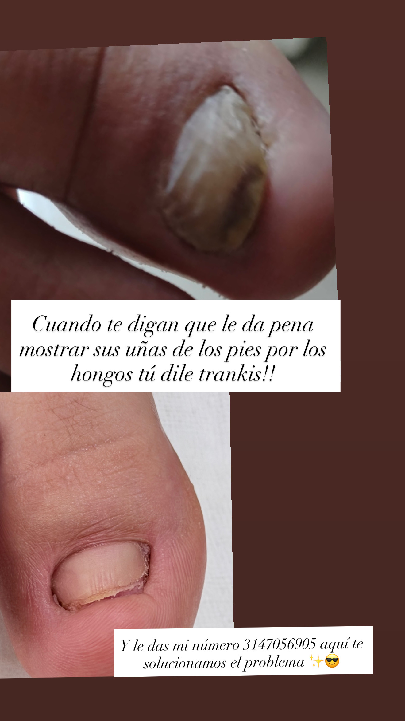 Foto del servicio Pedicure con énfasis en Quiropedia