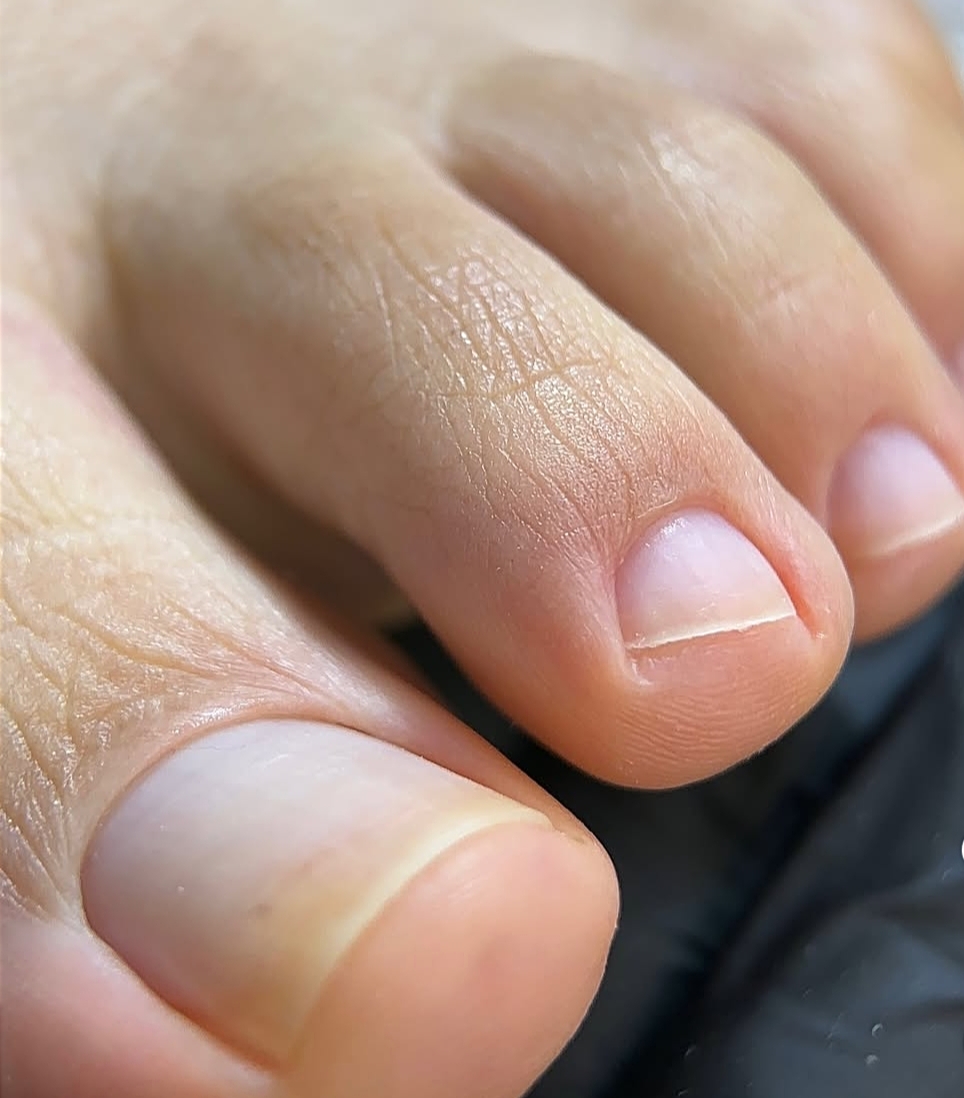 Foto del servicio Pedicura Limpieza