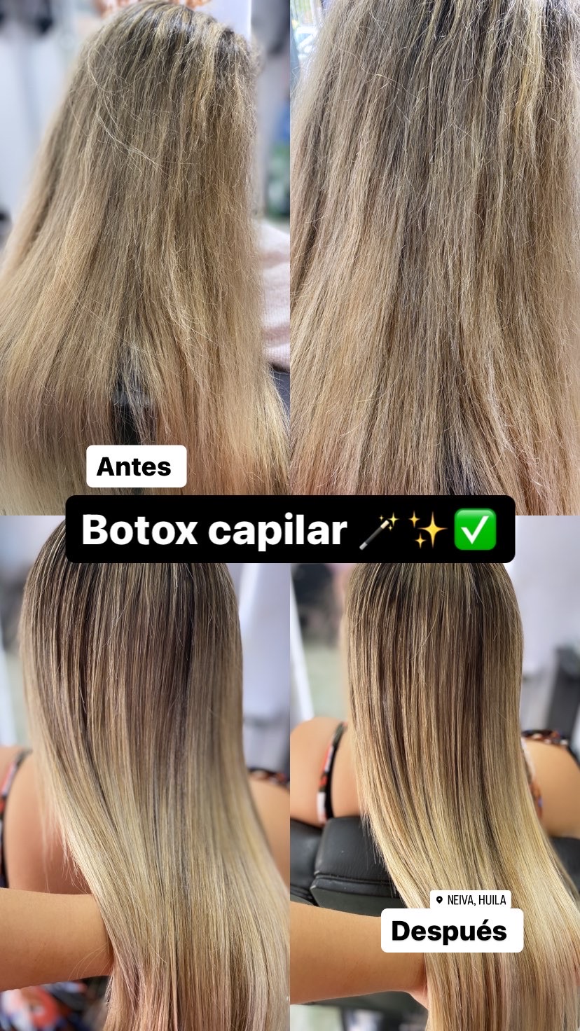 Foto del servicio Botox capilar
