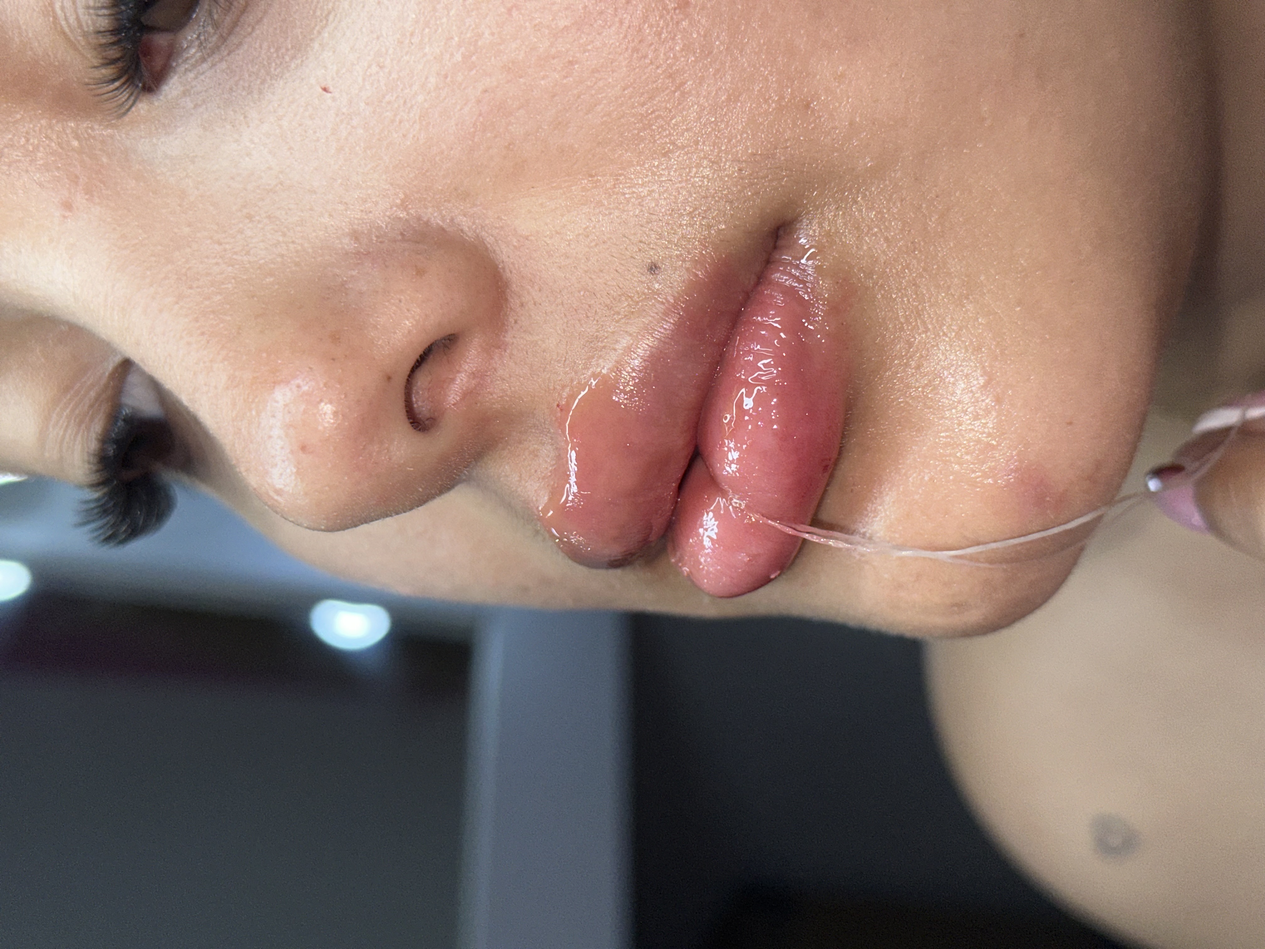 Foto del servicio Aumento de labios 💋