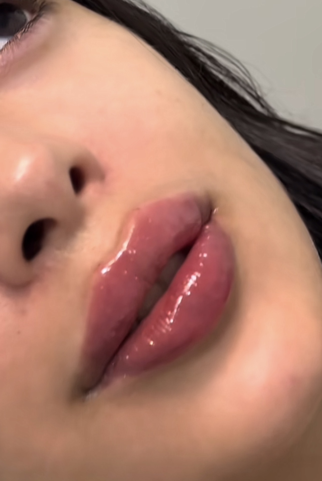 Foto del servicio Aumento de labios con color