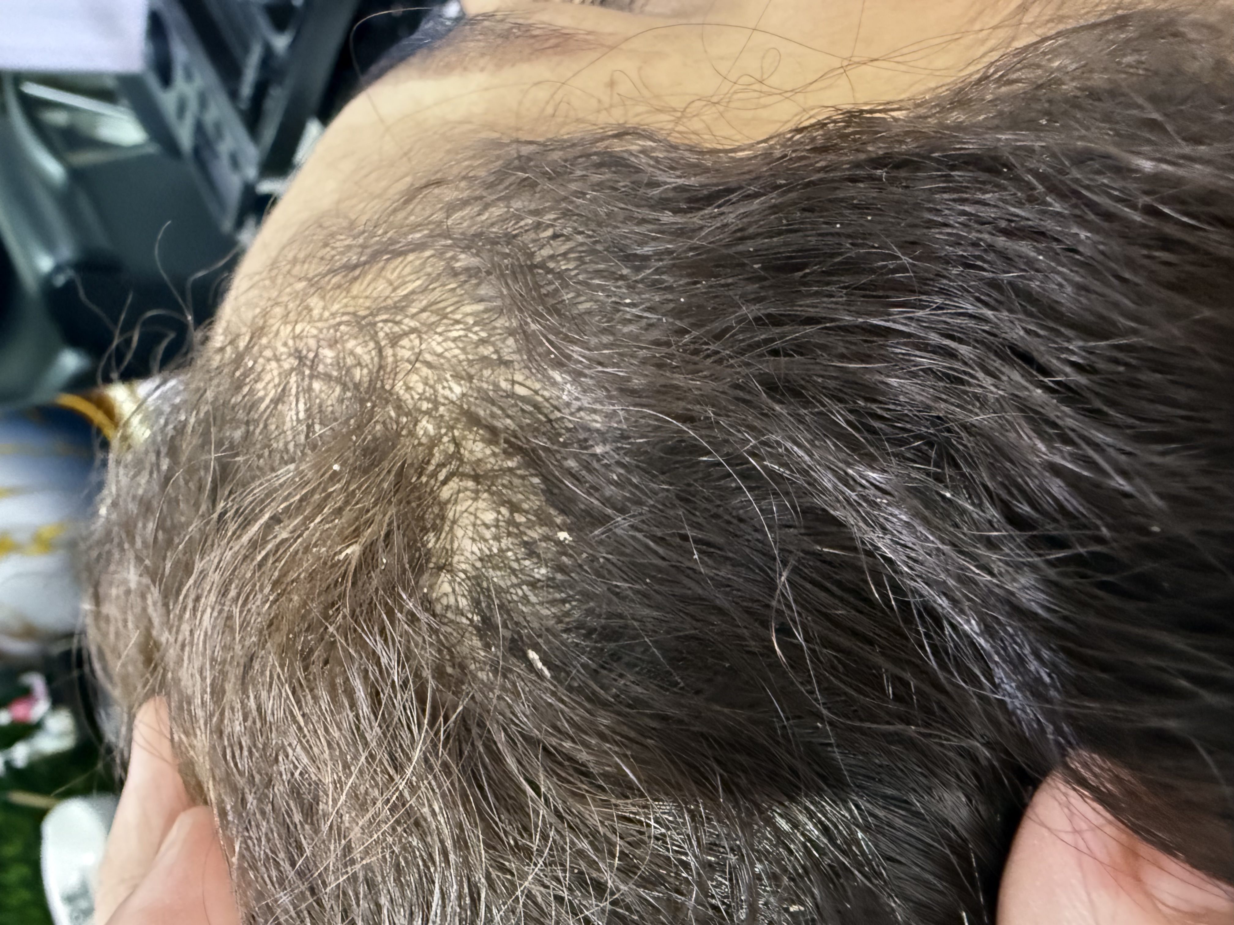 Foto del servicio Terapia DETOX capilar