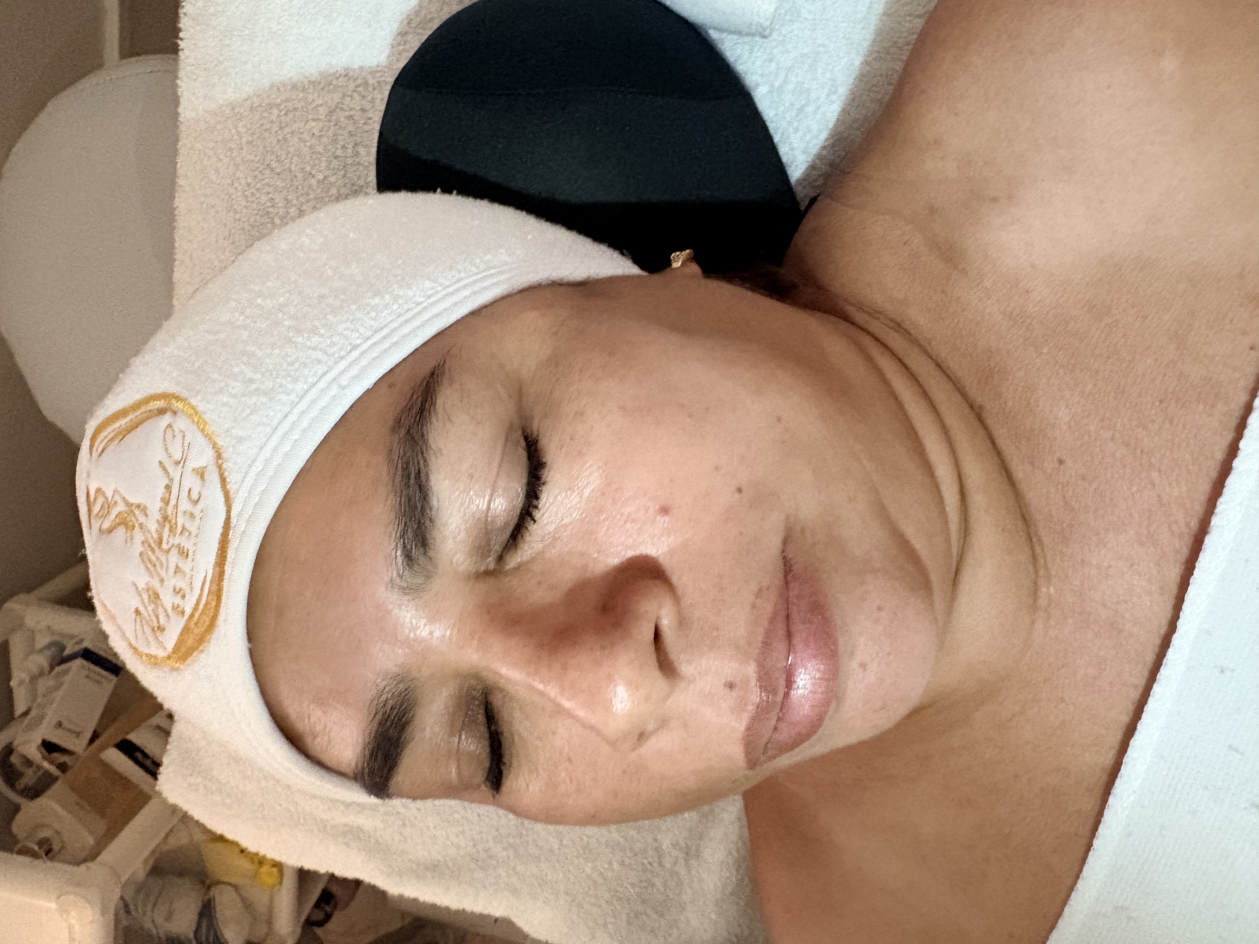 Foto del servicio Limpieza facial básica